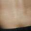 43. Stretch Marks Pictures