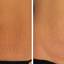25. Stretch Marks on Stomach Pictures