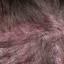 6. Folliculitis on Head Pictures