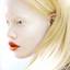 14. Albinism in humans Pictures