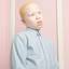 18. Albinism in humans Pictures