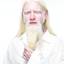 19. Albinism in humans Pictures