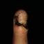 58. Papilloma on Finger Pictures