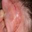 10. Eczema on the Ears Pictures