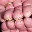 52. Dry Eczema on Hands Pictures