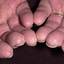 60. Eczema Hands Pictures