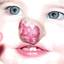 13. Hemangioma in Nose Pictures