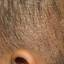 3. Hyperkeratosis on Head Pictures