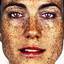 17. Freckles on Face Pictures
