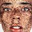 37. Freckles on Face Pictures