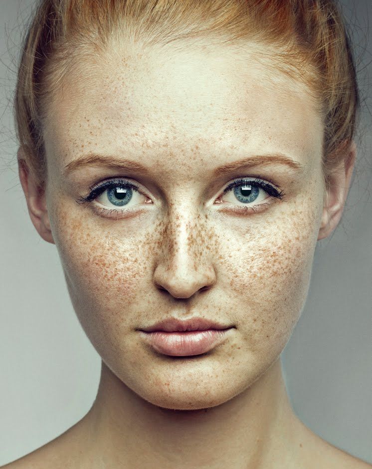 Freckles On Face Pictures 63 Photos And Images 
