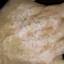 16. Vitiligo in White Person Pictures