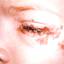 7. Eye Herpes Pictures
