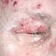 11. Herpes on Eyelid Pictures