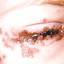 3. Herpes on Eyelid Pictures