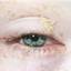 4. Herpes on Eyelid Pictures