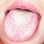 5. Scarlet Fever Tongue Pictures
