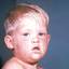 2. German Measles in Adults Pictures