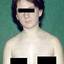 3. Rubella in Adults Pictures