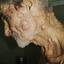 7. Leprosy Pictures