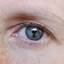 16. Ocular Melanoma Pictures