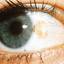 24. Ocular Melanoma Pictures