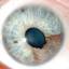 27. Ocular Melanoma Pictures